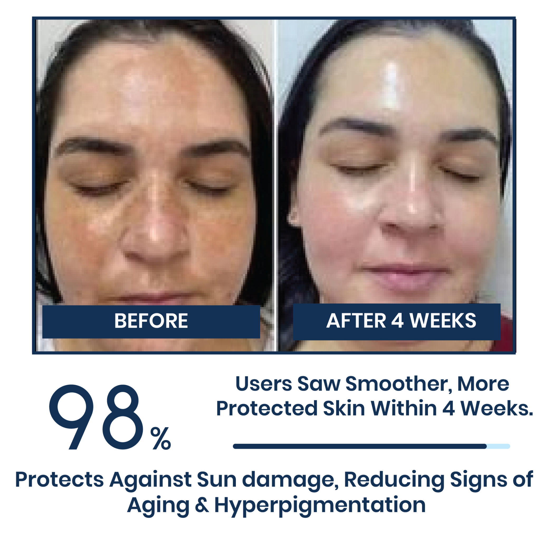 Skiby 1% Hyaluronic Sunscreen Aqua Gel 50g - SPF 50 PA++++ - Gel Based Sunscreen for Oily Skin & Combination Skin - Face Sunscreen for Women - Broad Spectrum Sun Screen Protection.